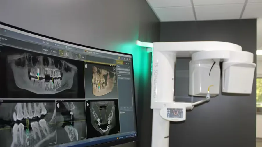 Cone Beam 3D imaging technology in an operatory at Norwell Oral Surgery